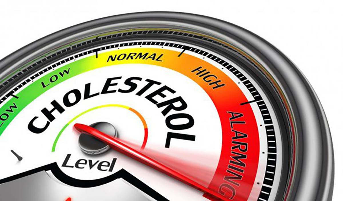 cholesterol cao