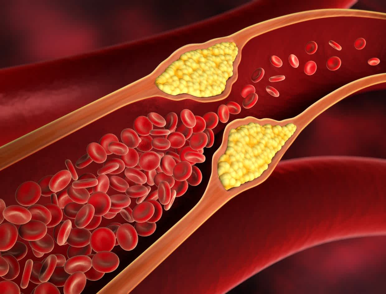 cholesterol