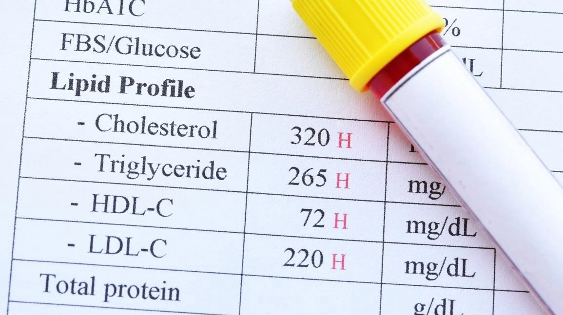 cholesterol cao