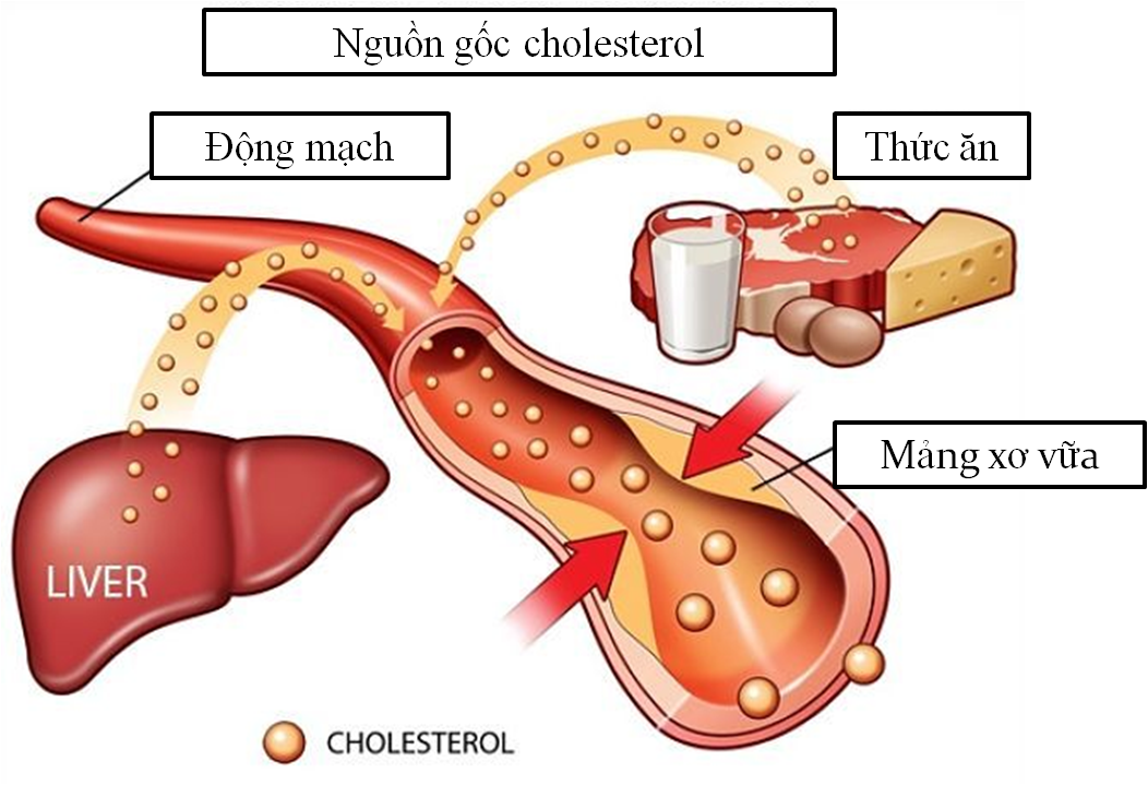 mỡ máu 