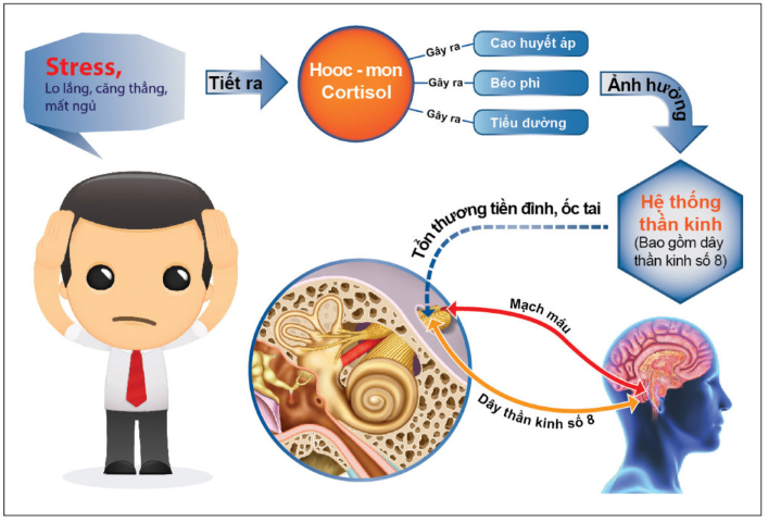 nguyên nhân rối loạn tiền đình