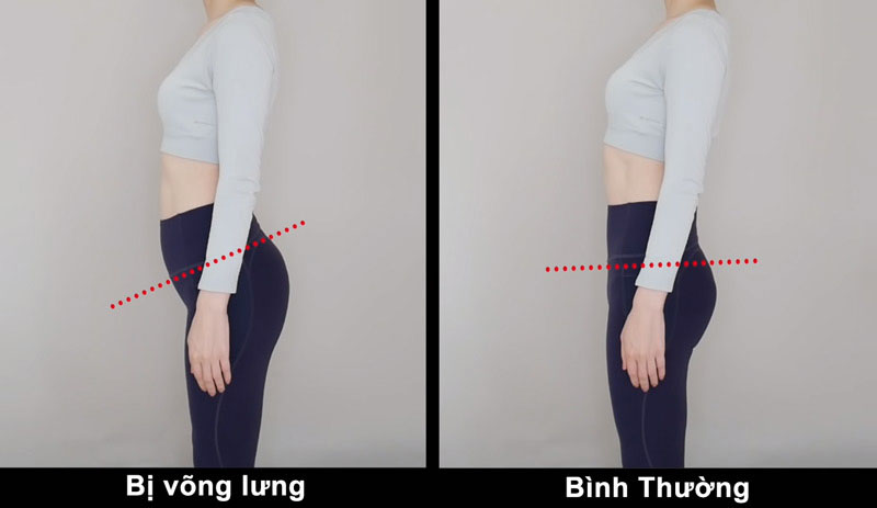 võng lưng